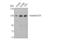 EPH Receptor A2 antibody, STJ92941, St John