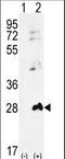 Adenylate kinase isoenzyme 1 antibody, LS-C100929, Lifespan Biosciences, Western Blot image 