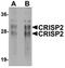 Cysteine Rich Secretory Protein 2 antibody, orb75471, Biorbyt, Western Blot image 