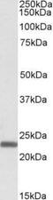 Claudin 14 antibody, PA1-31344, Invitrogen Antibodies, Western Blot image 