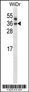 Patatin Like Phospholipase Domain Containing 4 antibody, 57-387, ProSci, Western Blot image 