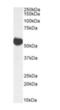 Aldehyde Dehydrogenase 5 Family Member A1 antibody, orb403022, Biorbyt, Western Blot image 