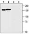 Potassium Voltage-Gated Channel Subfamily H Member 6 antibody, PA5-77629, Invitrogen Antibodies, Western Blot image 