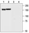 Potassium Voltage-Gated Channel Subfamily H Member 6 antibody, PA5-77629, Invitrogen Antibodies, Western Blot image 