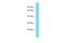 ENAH Actin Regulator antibody, PA5-70288, Invitrogen Antibodies, Western Blot image 