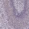 IKAROS Family Zinc Finger 1 antibody, NBP2-38242, Novus Biologicals, Immunohistochemistry frozen image 