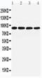 Transglutaminase 1 antibody, PA1956, Boster Biological Technology, Western Blot image 