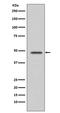 Vasodilator Stimulated Phosphoprotein antibody, M00303, Boster Biological Technology, Western Blot image 