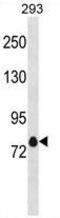 Potassium Voltage-Gated Channel Subfamily A Member 4 antibody, GTX53679, GeneTex, Western Blot image 