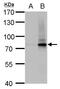 SLU7 Homolog, Splicing Factor antibody, MA5-18296, Invitrogen Antibodies, Western Blot image 