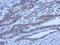 Forkhead Box O1 antibody, GTX70193, GeneTex, Immunohistochemistry paraffin image 