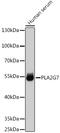 Platelet-activating factor acetylhydrolase antibody, GTX66220, GeneTex, Western Blot image 