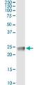 Claudin 4 antibody, H00001364-M02, Novus Biologicals, Immunoprecipitation image 