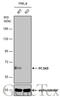 Proprotein Convertase Subtilisin/Kexin Type 9 antibody, GTX129859, GeneTex, Western Blot image 