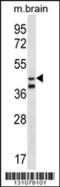Origin Recognition Complex Subunit 5 antibody, 56-853, ProSci, Western Blot image 