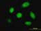 Cathepsin K antibody, H00001513-M01, Novus Biologicals, Immunofluorescence image 