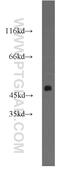 Isocitrate Dehydrogenase (NADP(+)) 1, Cytosolic antibody, 12332-1-AP, Proteintech Group, Western Blot image 