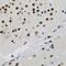 SPIN antibody, GTX65927, GeneTex, Immunohistochemistry paraffin image 