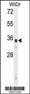 WD Repeat Domain 5B antibody, 55-591, ProSci, Western Blot image 