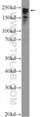 Myosin Heavy Chain 6 antibody, 22281-1-AP, Proteintech Group, Western Blot image 