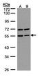Carbonic Anhydrase 9 antibody, orb74096, Biorbyt, Western Blot image 