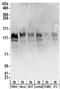 Diphosphoinositol Pentakisphosphate Kinase 2 antibody, NBP2-32155, Novus Biologicals, Western Blot image 
