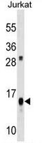 ATP Synthase F1 Subunit Delta antibody, AP50299PU-N, Origene, Western Blot image 