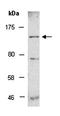 ATPase Phospholipid Transporting 11A antibody, orb67158, Biorbyt, Western Blot image 