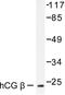 Choriogonadotropin subunit beta antibody, LS-C176054, Lifespan Biosciences, Western Blot image 