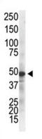 Inhibitor Of Nuclear Factor Kappa B Kinase Regulatory Subunit Gamma antibody, abx025557, Abbexa, Western Blot image 