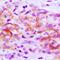 Protocadherin Alpha 12 antibody, LS-C668890, Lifespan Biosciences, Immunohistochemistry paraffin image 