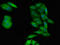 Protein Phosphatase 1 Catalytic Subunit Alpha antibody, LS-C679117, Lifespan Biosciences, Immunofluorescence image 
