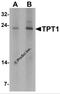 Translationally-controlled tumor protein antibody, 7193, ProSci Inc, Western Blot image 
