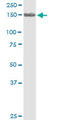 Polycystin 2, Transient Receptor Potential Cation Channel antibody, LS-C197911, Lifespan Biosciences, Western Blot image 