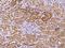 GRB2 Associated Binding Protein 2 antibody, 200517-T08, Sino Biological, Immunohistochemistry paraffin image 