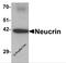 Dorsal Inhibitory Axon Guidance Protein antibody, 6493, ProSci, Western Blot image 