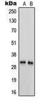 Serine protease 3 antibody, MBS820513, MyBioSource, Western Blot image 