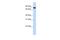 Glycogen [starch] synthase, liver antibody, A08086, Boster Biological Technology, Western Blot image 