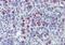 Mycobacterium tuberculosis groEL antibody, orb89061, Biorbyt, Immunohistochemistry paraffin image 