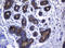 Heat Shock Protein Family D (Hsp60) Member 1 antibody, LS-C175467, Lifespan Biosciences, Immunohistochemistry paraffin image 