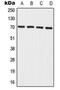 Interleukin-27 receptor subunit alpha antibody, MBS821470, MyBioSource, Western Blot image 