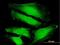 NPR2 Like, GATOR1 Complex Subunit antibody, H00010641-B01P, Novus Biologicals, Immunocytochemistry image 