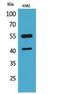 Interleukin 2 Receptor Subunit Gamma antibody, STJ96745, St John