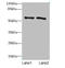 Glutamic--Pyruvic Transaminase antibody, A56418-100, Epigentek, Western Blot image 