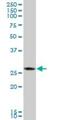 Chymotrypsinogen B1 antibody, H00001504-B01P, Novus Biologicals, Western Blot image 