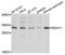 Ring Finger And CHY Zinc Finger Domain Containing 1 antibody, abx006760, Abbexa, Western Blot image 