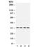 Lysyl Oxidase antibody, R32045, NSJ Bioreagents, Western Blot image 