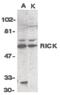 Receptor Interacting Serine/Threonine Kinase 2 antibody, PA5-19905, Invitrogen Antibodies, Western Blot image 