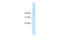 Nudix Hydrolase 9 antibody, 28-310, ProSci, Western Blot image 