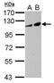 Adenylate Cyclase 2 antibody, GTX117223, GeneTex, Western Blot image 